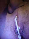 Prostaat massage, foto 1728x2304, 4 reacties, 12 stemmen