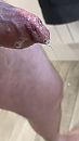 Voorvocht druipt eruit....., foto 505x898, 2 reacties, 4 stemmen