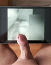 Zaad schieten, film 00:00:00, 1 reacties, 12 stemmen