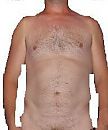 iets bloter, foto 192x230, 1 reacties, 4 stemmen