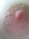 mooie tepel, foto 600x800, 19 reacties, 61 stemmen