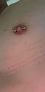 piercing, foto 1592x3264, 12 reacties, 10 stemmen