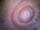 tepel, foto 640x480, 7 reacties, 15 stemmen