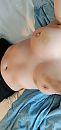 After some biting, foto 864x1812, 11 reacties, 122 stemmen