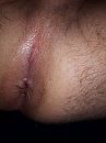 Ass, foto 3000x4000, 4 reacties, 21 stemmen