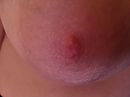 Nipple, foto 4000x3000, 11 reacties, 20 stemmen