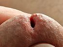 Close-up Eikel., foto 4000x3000, 2 reacties, 7 stemmen