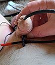 Estim in urethra, foto 2604x3023, 5 reacties, 12 stemmen
