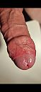 Gezwollen knop, foto 1080x2400, 6 reacties, 18 stemmen