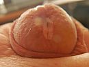 Glans penis latijns voor eikrl, foto 2444x1833, 0 reacties, 3 stemmen