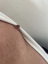 Mijn XXL nipple, foto 962x1275, 1 reacties, 2 stemmen