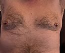 Net gepierced…, foto 870x710, 3 reacties, 10 stemmen