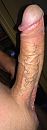 Pik aderen, foto 377x1022, 2 reacties, 5 stemmen