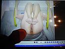Voor Bichat, foto 2592x1944, 1 reacties, 3 stemmen