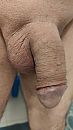 al een licht gezwollen penis, foto 2252x4000, 1 reacties, 4 stemmen