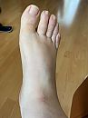 voet, foto 3000x4000, 3 reacties, 5 stemmen