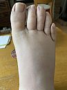 voet, foto 1440x1920, 1 reacties, 5 stemmen