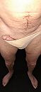 Oeps string te klein of......., foto 1802x4000, 5 reacties, 9 stemmen