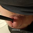 Opblaasbare dilator, film 00:00:13, 2 reacties, 10 stemmen
