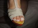 Puffy feet, foto 3648x2736, 3 reacties, 16 stemmen