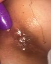anus net genomen, foto 794x990, 1 reacties, 4 stemmen