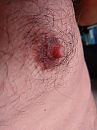 mmm, foto 3000x4000, 2 reacties, 3 stemmen