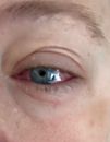 sperm eyes, foto 1577x2022, 4 reacties, 19 stemmen