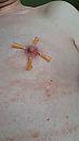 4 naalden in tepel, foto 2152x3824, 0 reacties, 0 stemmen