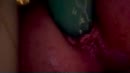 De laatste, film 00:00:28, 1 reacties, 6 stemmen