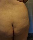 Heerlijke grote reet van haar!, foto 3020x3572, 6 reacties, 19 stemmen