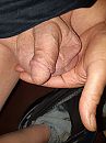 Lege zak na 5 uur saline, foto 3000x4000, 0 reacties, 2 stemmen