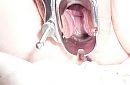 BDSM, fetish en extreem