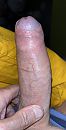 Nachtstijfheid, foto 1848x3623, 0 reacties, 2 stemmen