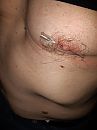 Nipple needle, foto 3000x4000, 3 reacties, 11 stemmen