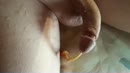 Open katheter., film 00:00:16, 2 reacties, 2 stemmen