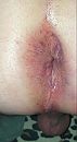 Spanked ass, foto 442x799, 3 reacties, 5 stemmen