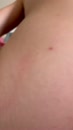 Spuit maar, film 00:00:19, 3 reacties, 18 stemmen