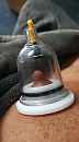 Suction cup, foto 1634x2933, 3 reacties, 9 stemmen