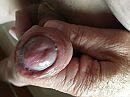 Voorhuidje, foto 4000x3000, 4 reacties, 7 stemmen