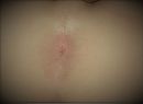 anus, foto 572x420, 11 reacties, 17 stemmen