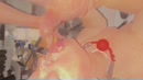 bek vol spuiten, film 00:00:22, 24 reacties, 113 stemmen bek vol spuiten, film 00:00:22, 24 reacties, 113 stemmen