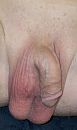 erectieproblemen, foto 287x484, 1 reacties, 1 stemmen