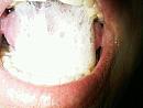 Alweer, foto 1012x762, 3 reacties, 5 stemmen