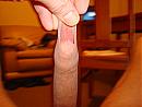 foreskin, foto 3072x2304, 0 reacties, 1 stemmen