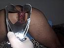 met de speculum, foto 800x602, 0 reacties, 1 stemmen
