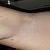 fladders